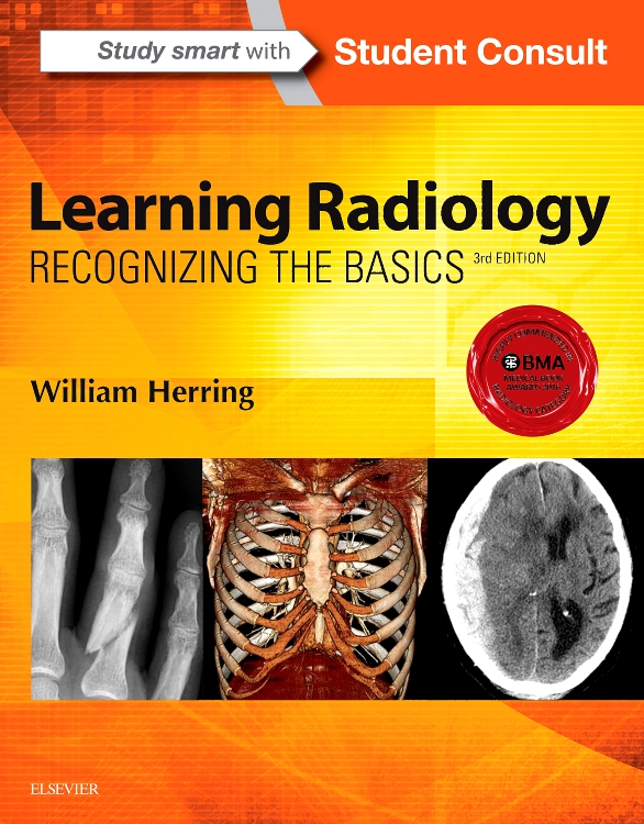 Learning Radiology