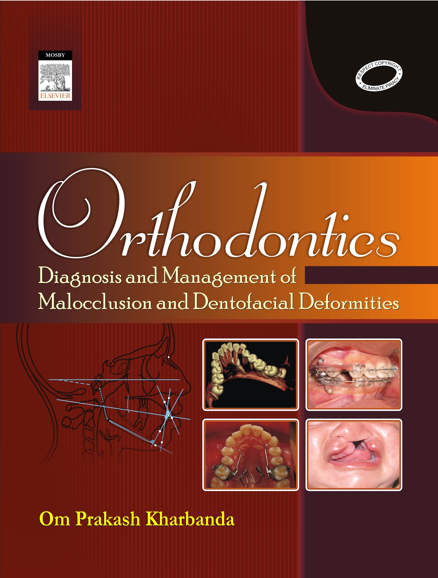 Orthodontics: Diagnosis of & Management of Malocclusion & Dentofacial Deformities