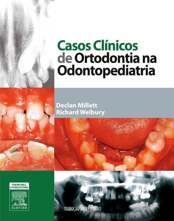 Casos Clínicos de Ortodontia na Odontopediatria