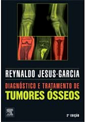 Diagnóstico e Tratamento de Tumores Ósseos