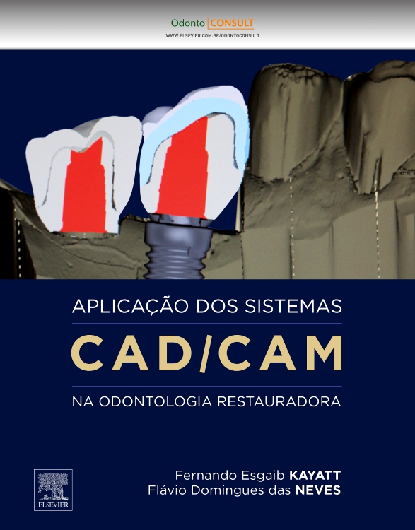 Aplicação dos Sistemas CAD/CAM na Odontologia