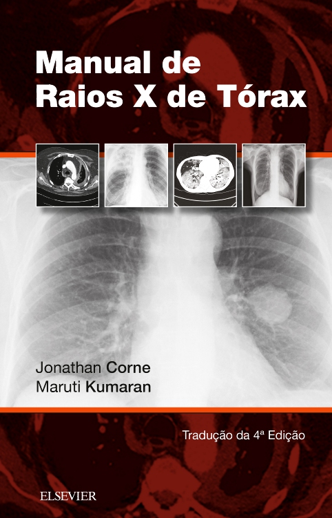 Manual de Raios-X de Tórax