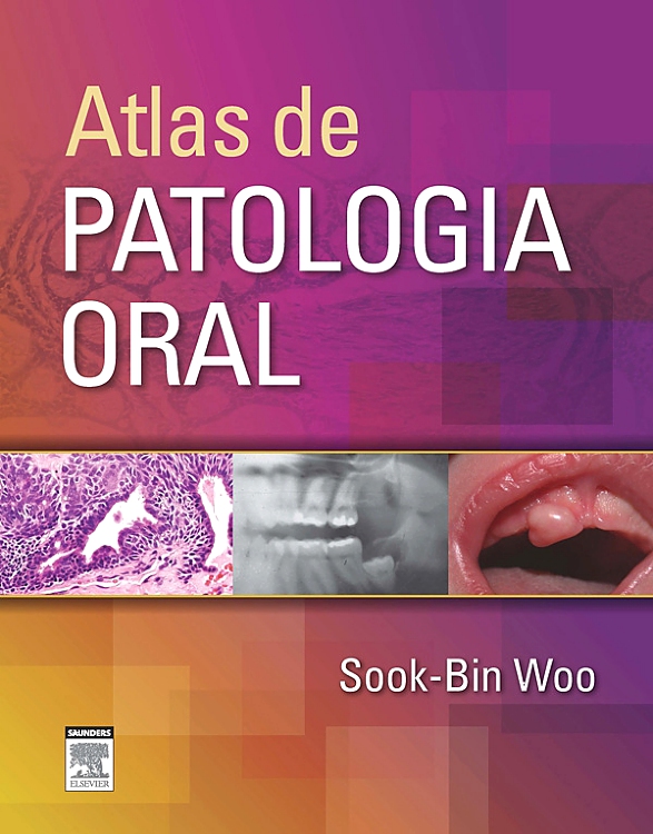 Atlas de Patologia Oral