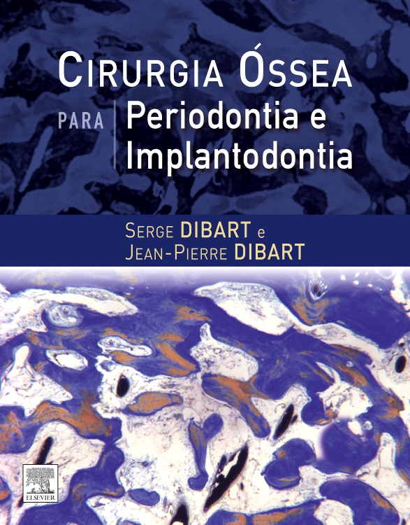 Cirurgia Óssea para Periodontia e Implantodontia