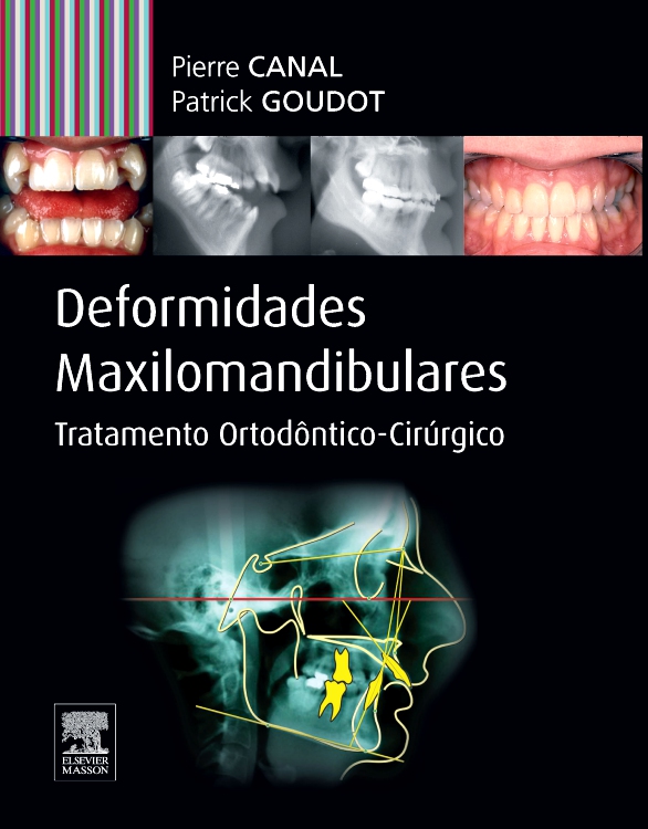 Deformidades Maxilo-mandibulares