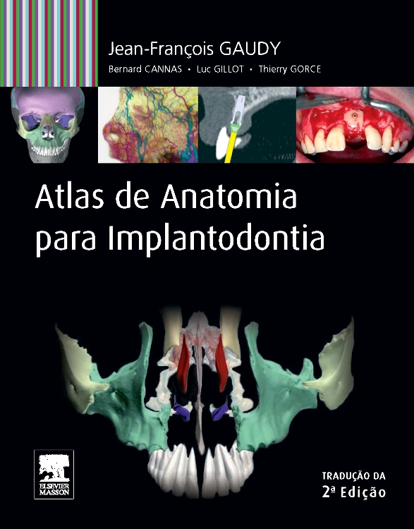 Atlas de Anatomia para Implantodontia