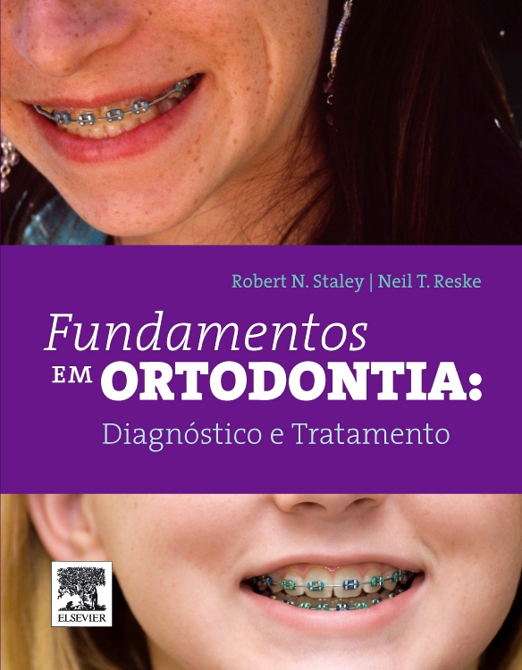 Fundamentos em Ortodontia: Diagnóstico e Tratamento