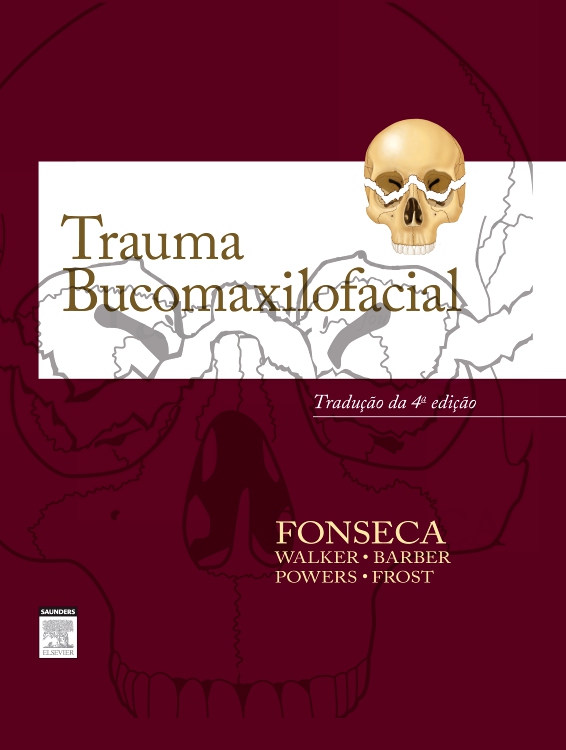 Trauma Bucomaxilofacial
