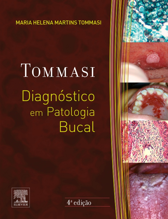 Diagnóstico em Patologia Bucal