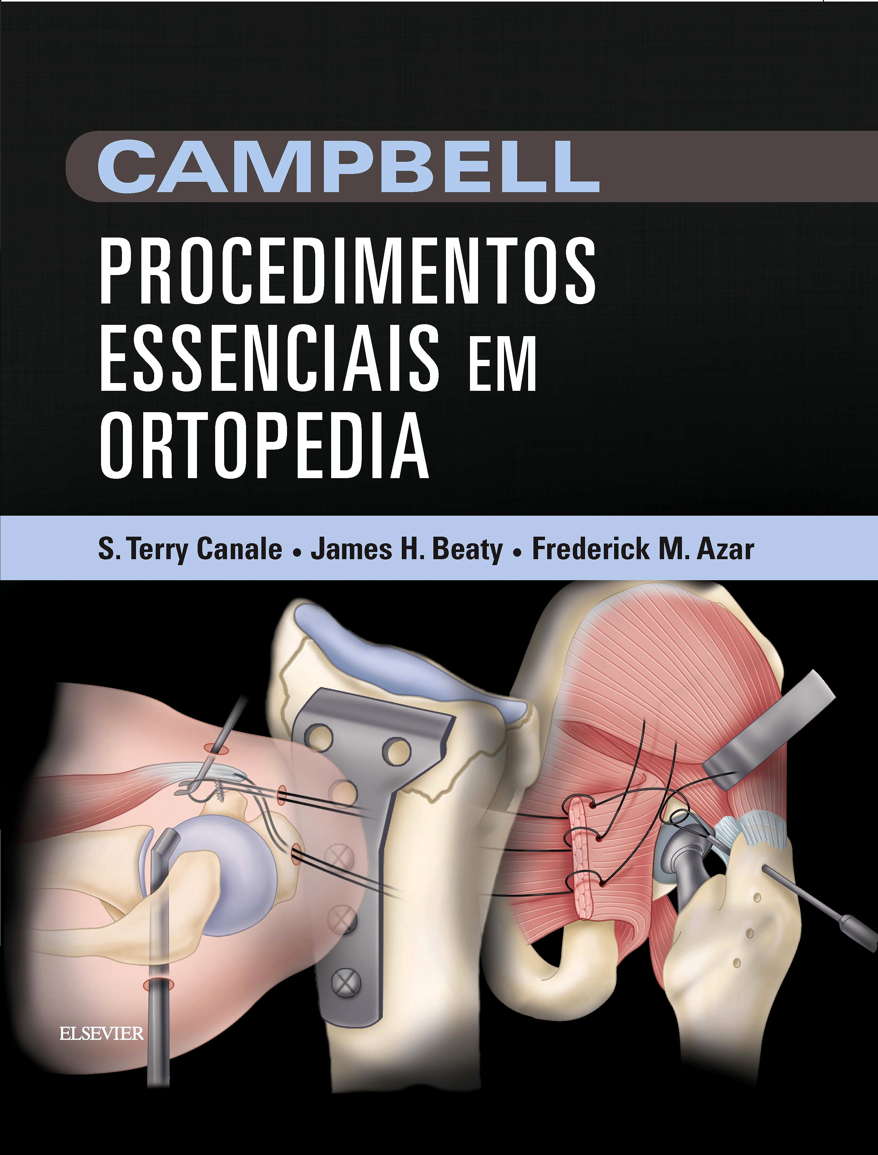 CAMPBELL Procedimentos Essenciais em Ortopedia
