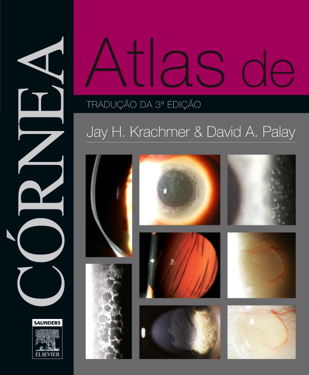 Atlas de Córnea