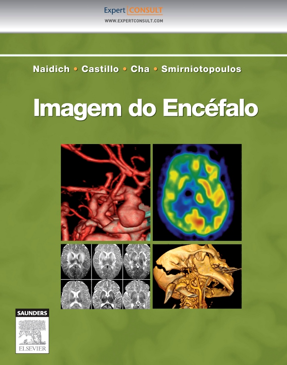 Imagem do Encéfalo