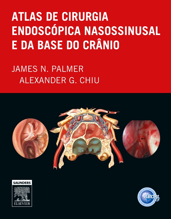 Atlas de Cirurgia Endoscópica Nanossinusal e da Base do Crânio