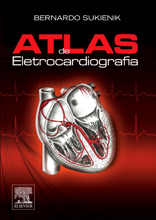 Atlas de Eletrocardiografia