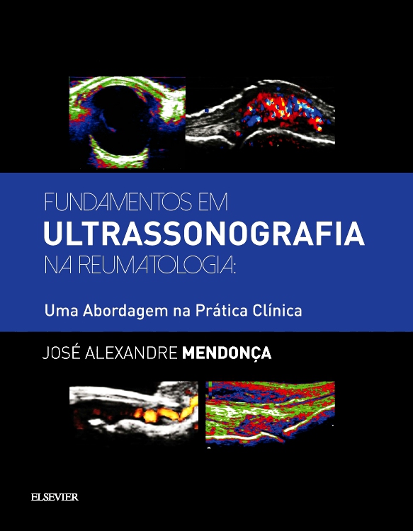 Fundamentos em Ultrassonografia na Reumatologia