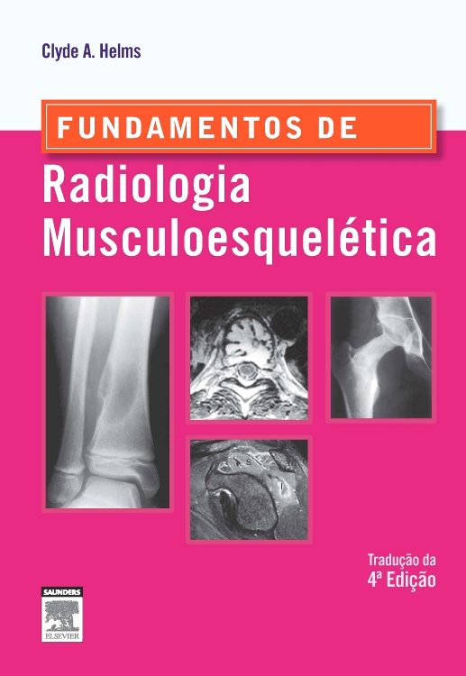 Fundamentos de Radiologia Musculoesquelética