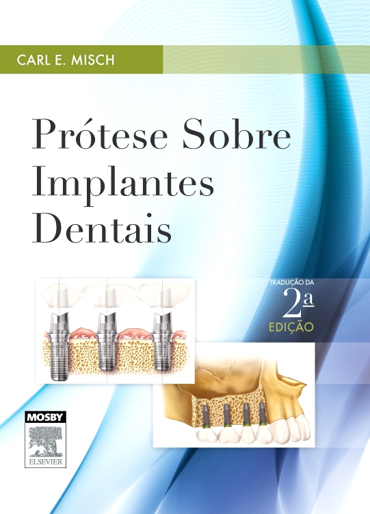 Prótese sobre Implantes Dentais