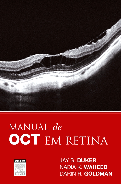 Manual de OCT em Retina