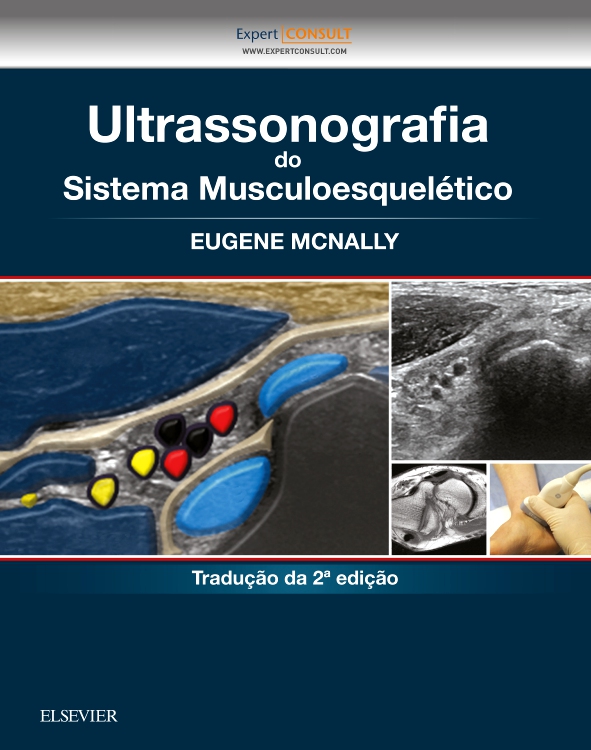 Ultrassonografia do Sistema Musculoesquelético