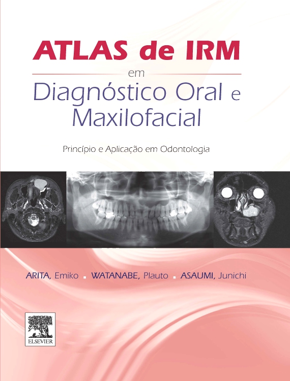 Atlas de IRM em Diagnóstico Oral e Maxilofacial