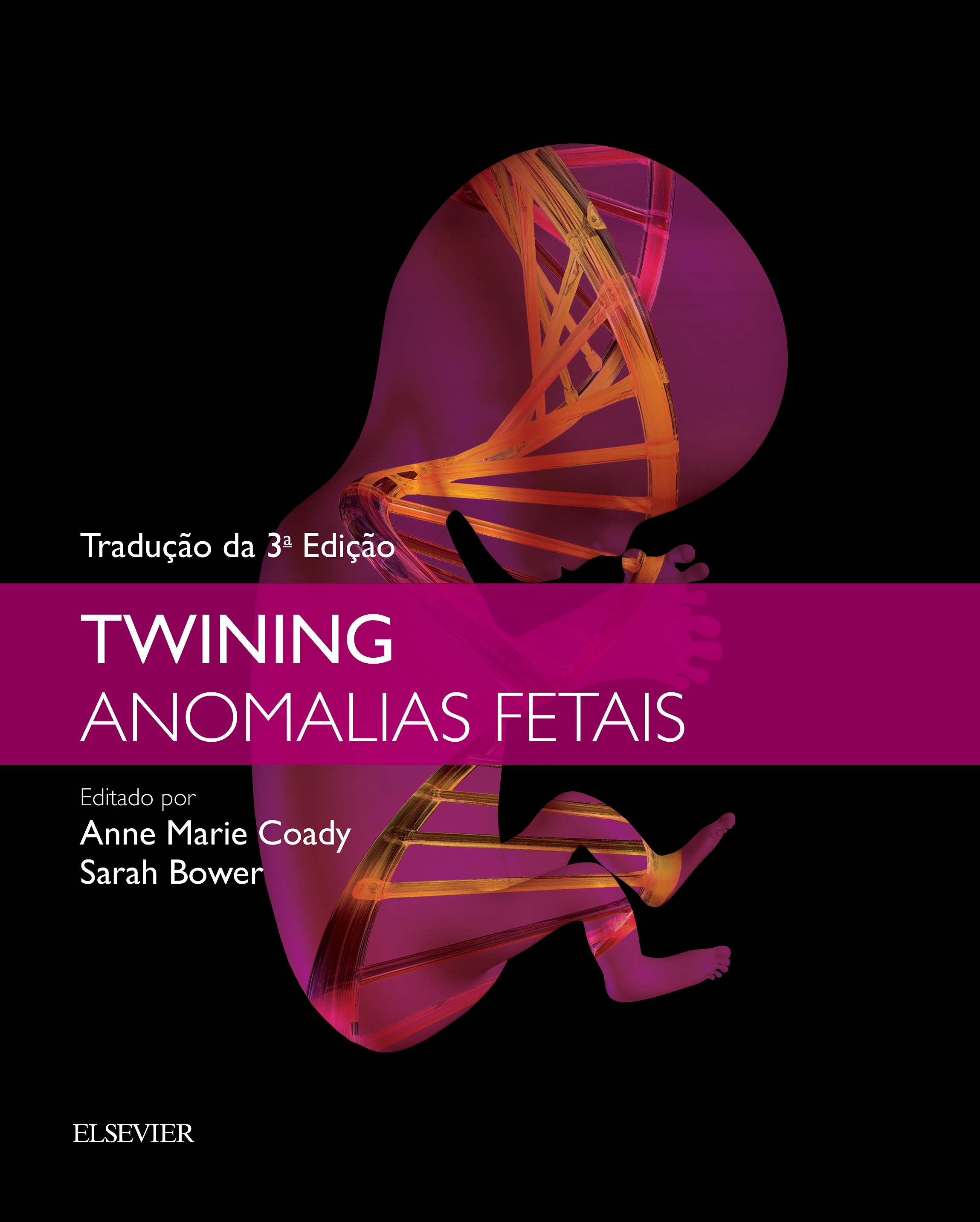 Twining Anomalias Fetais