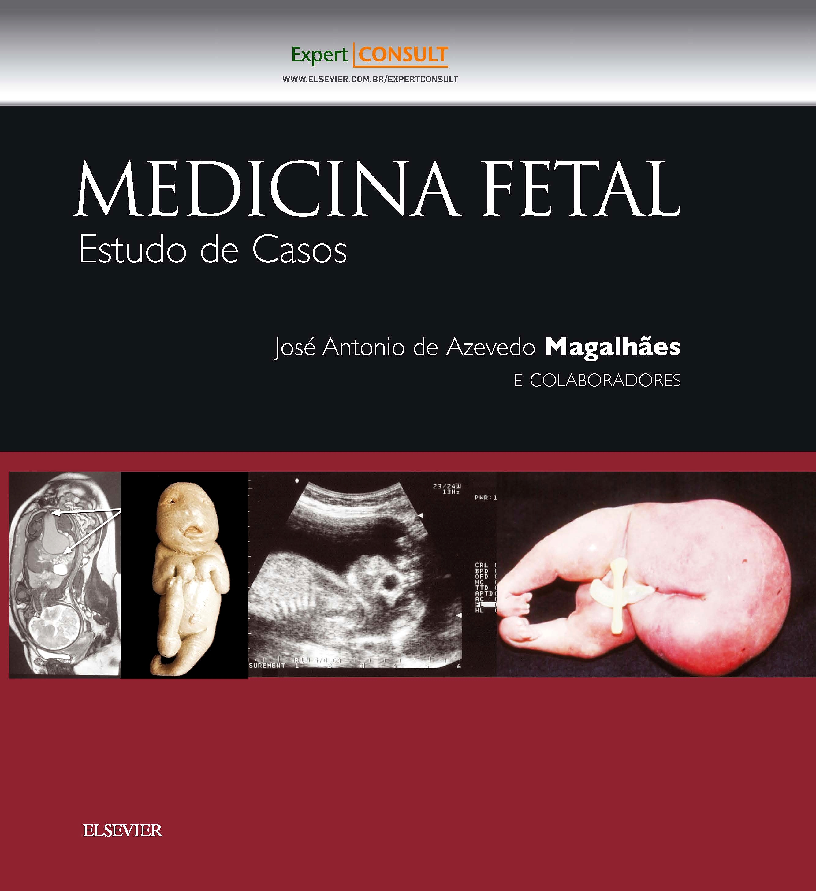 Medicina Fetal - Estudo de Casos