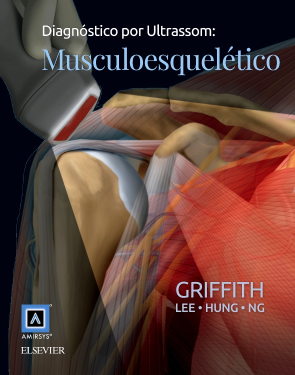 Diagnóstico por Ultrassom: Musculoesquelético