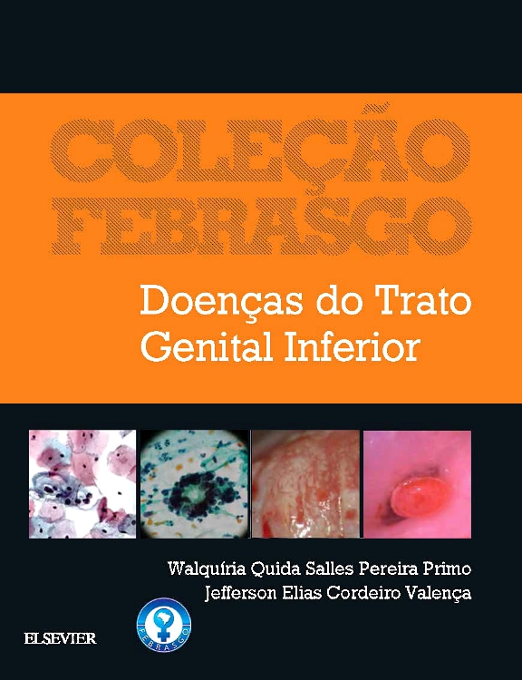 Doenças do Trato Genital Inferior