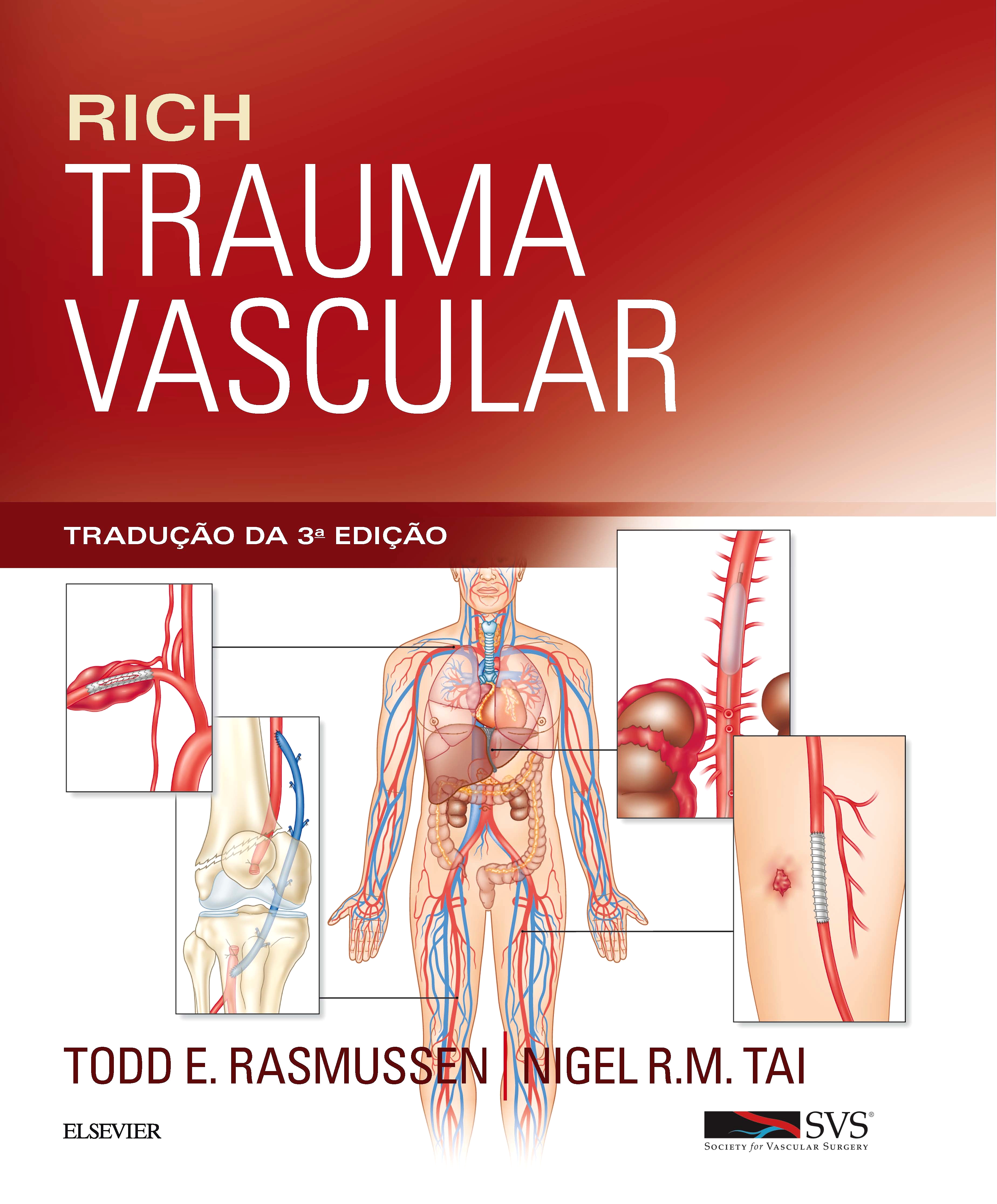 Rich Trauma Vascular