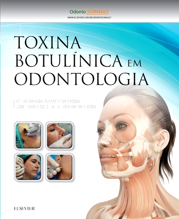 Toxina Botulínica em Odontologia