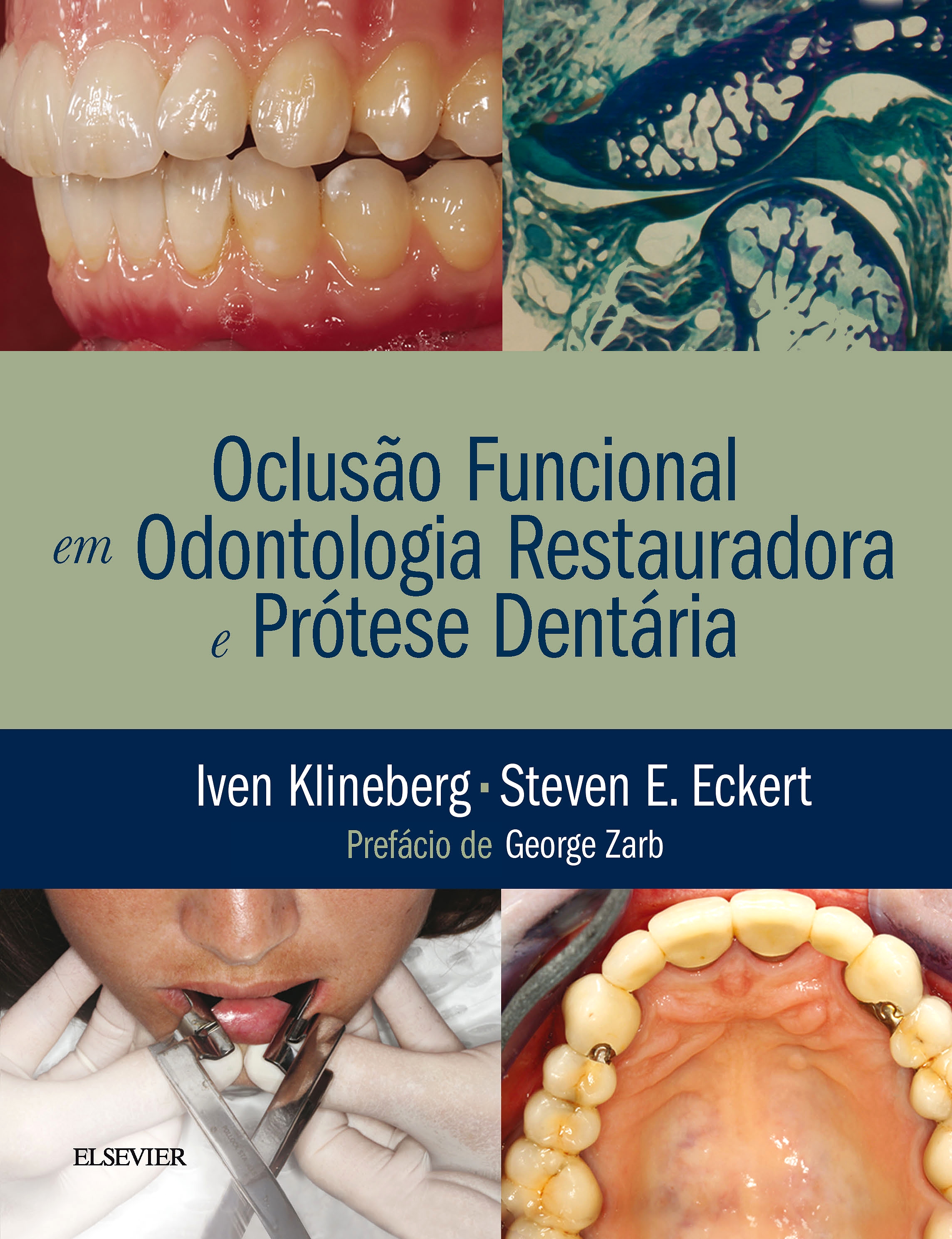 Oclusão Funcional em Odontologia Restauradora e Prótese