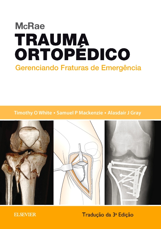 McRae Trauma Ortopédico