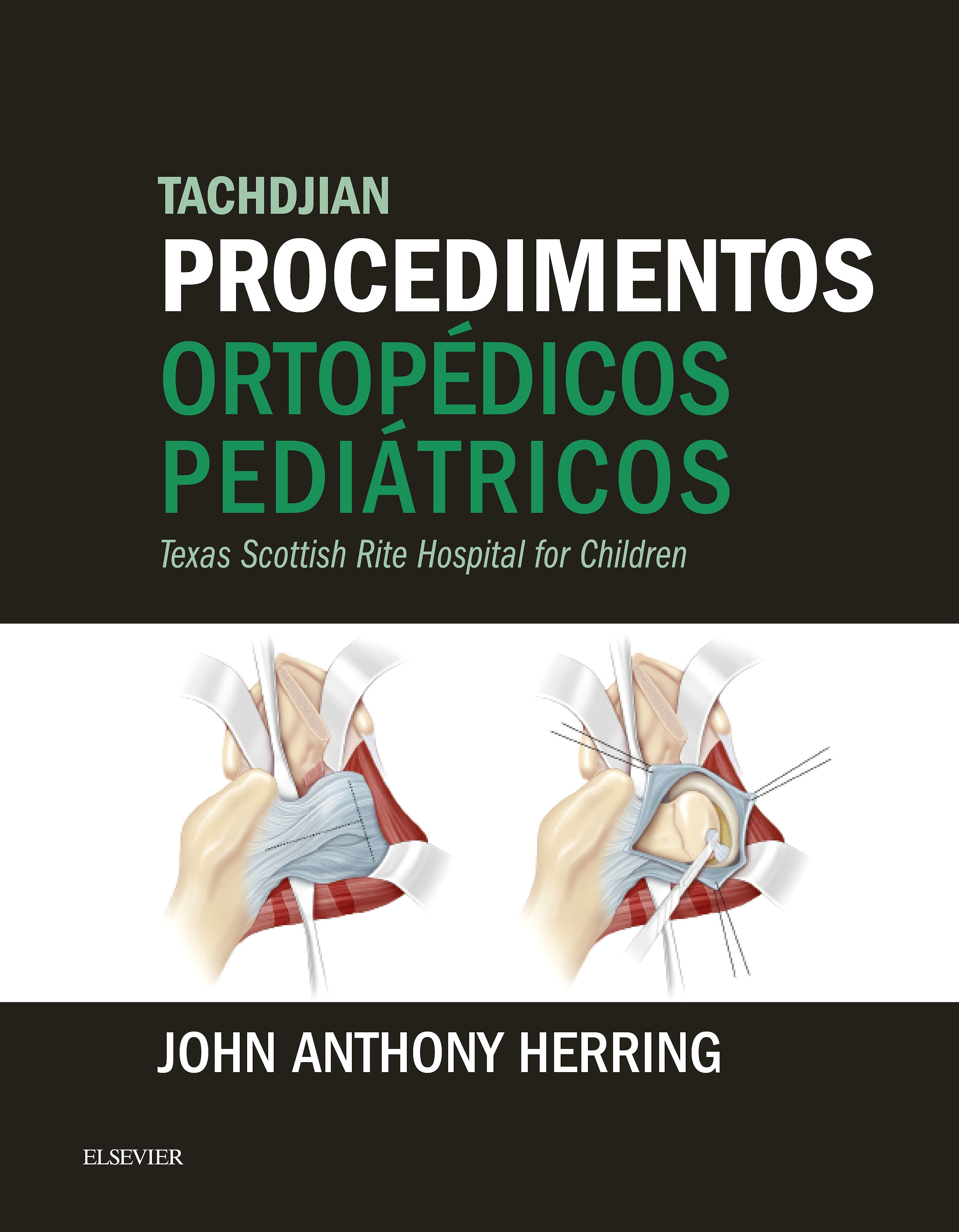 Tachdjian Procedimentos Ortopédicos Pediátricos