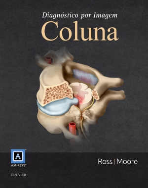 Diagnóstico por Imagem: Coluna