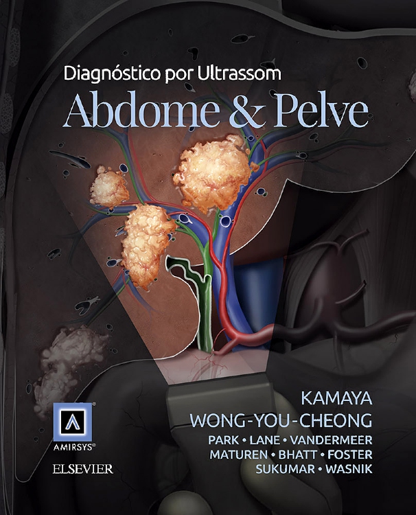 Diagnostico por Ultrassom: Abdome e Pelve