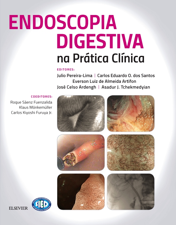 Endoscopia Digestiva na Prática Clínica