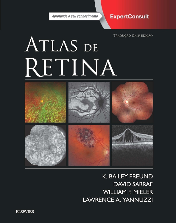 Atlas de Retina