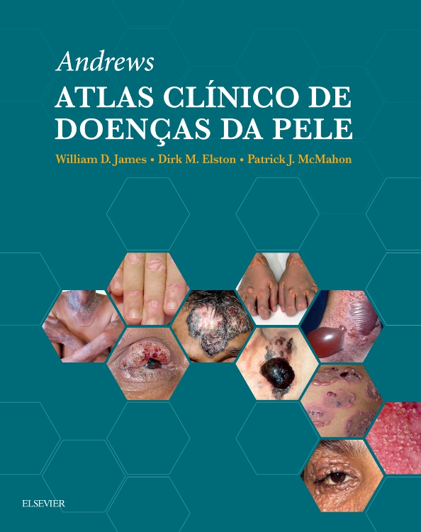 Andrew Atlas Clínico de Doenças da Pele