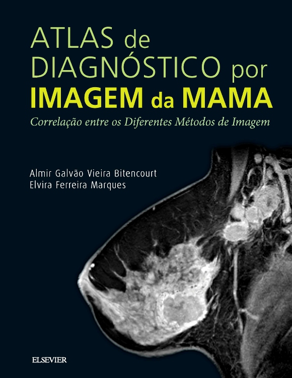Atlas de Diagnóstico por Imagem de Mama