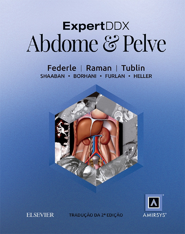 ExpertDDX: Abdome e Pelve