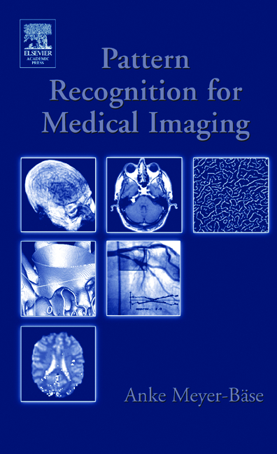 Pattern Recognition and Signal Analysis in Medical Imaging