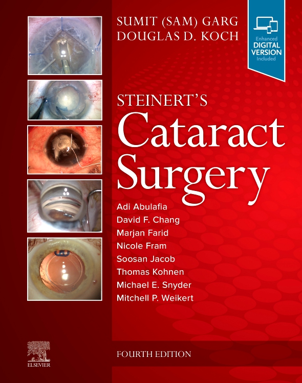 Steinert's Cataract Surgery