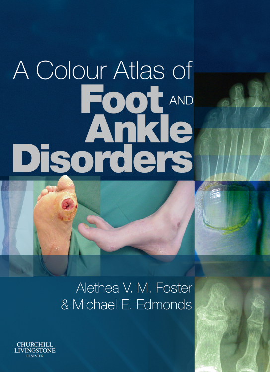 A Colour Atlas Of Foot And Ankle Disorders Edition By Alethea Vm Foster Ba Hons Pgce