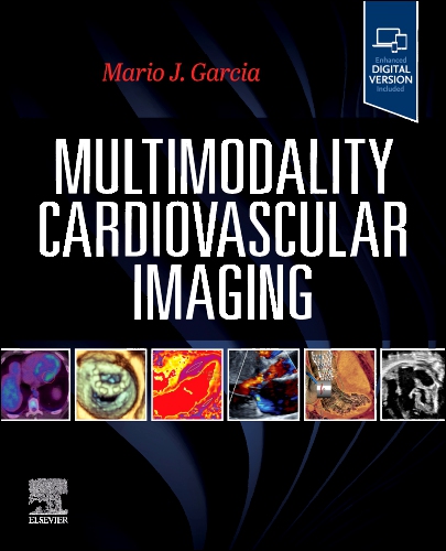 Multimodality Cardiovascular Imaging