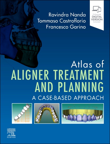 健康・医学 267 Aligner Orthodontics and Orofacial Atlas of Aligner Treatment and Planning - Edition 1 - Edited by