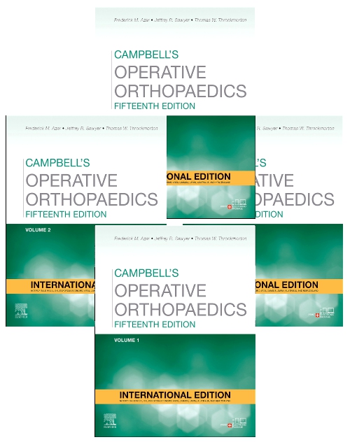 Campbell's Operative Orthopaedics, 4-Volume Set - International Edition