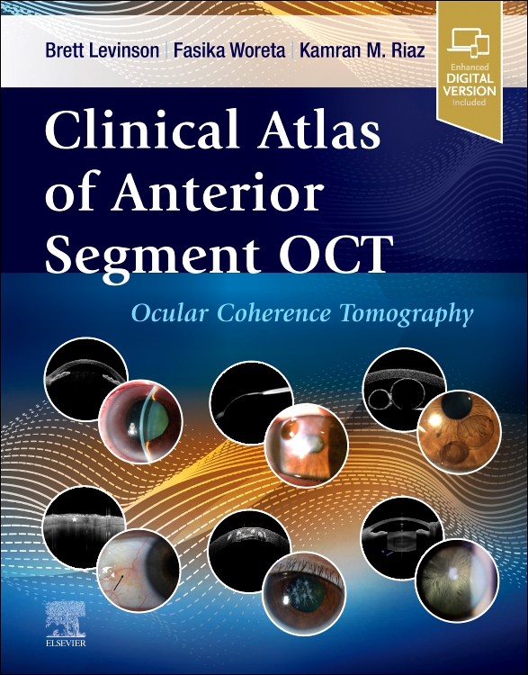Clinical Atlas of Anterior Segment OCT: Optical Coherence Tomography