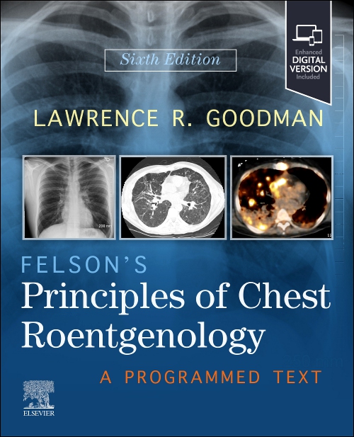 Felson's Principles of Chest Roentgenology