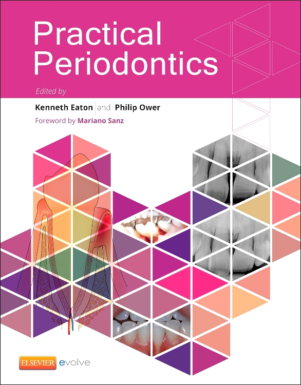 Newman And Carranza S Clinical Periodontology Edition 13 By