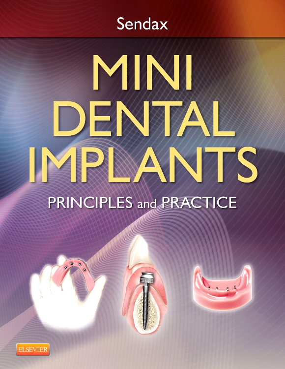 Mini Dental Implants